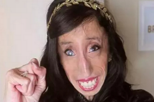lizzie velasquez