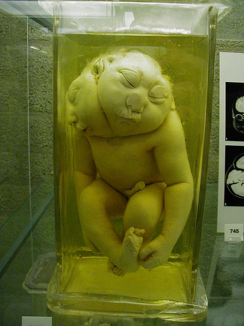 费城马特博物馆