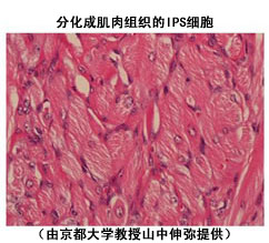  p data-id="gnwp7dfzcj">心肌细胞又称心肌纤维,有横纹,受 a target=