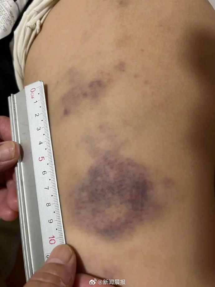 2024年8月21日青岛男童遭老师殴打事件