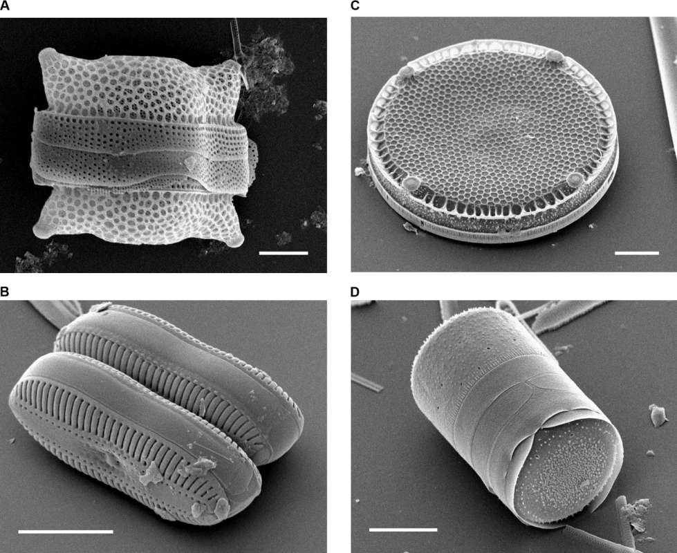  p>硅藻纲(diatoms),属于褐藻类的特殊形态的藻类,是淡水或海水中的
