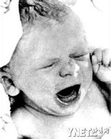  p>露薏丝·布朗/路易丝·布朗(louise joy brown),女,1978年7月25日