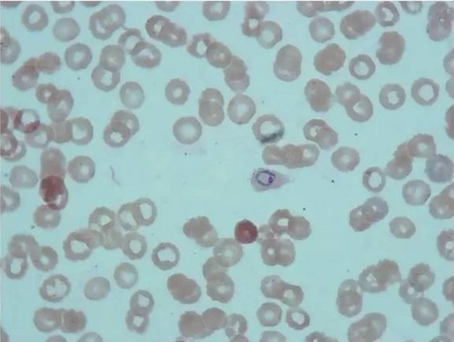 plasmodium