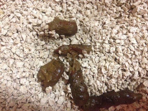  p>大便潜血(又称便隐血)是指消化道少量出血,红细胞被消化破坏,粪便