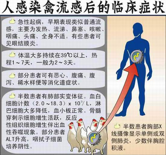 禽流感