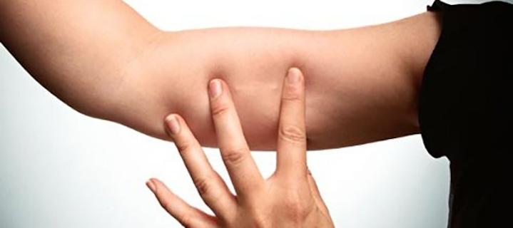  p>皮下埋植避孕法是一种新型的避孕方法,通过在使用者大臂内侧埋植