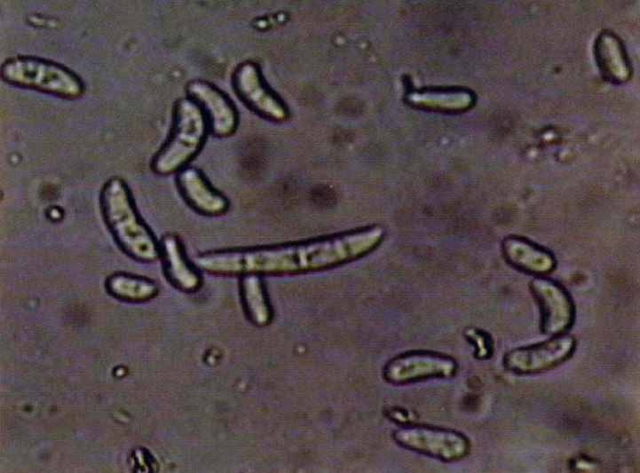  p>人参根腐病是由腐皮镰刀菌等引起的,发生在 a target="_blank"