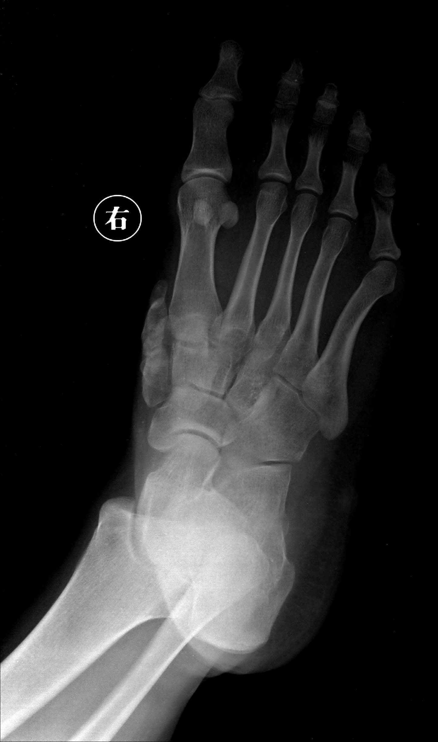  p data-id="sovgmno7zfeo">跖趾关节属椭圆关节,可作屈伸及轻微的收