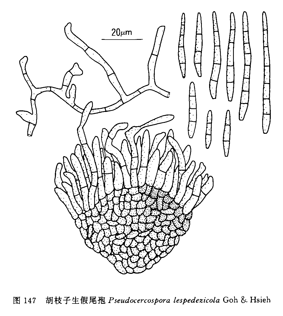  p>马来尾孢,链孢霉目,黑霉科,拉丁名cercospora malayensis. /p>