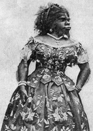 由于她的外表,朱丽亚被人们叫做"毛女",或者"女猿人"