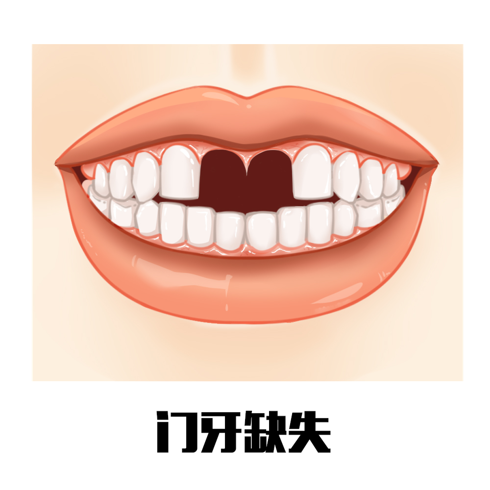 牙缺失
