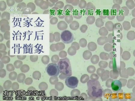 造血疑团