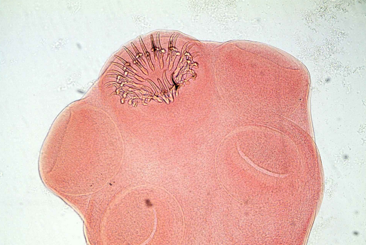  a target="_blank" href="/item/链状带绦虫/1546162" data-lemmaid=