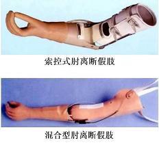 肘离断假肢