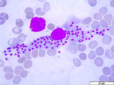 杜氏利什曼原虫