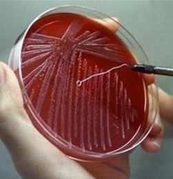 琼脂斜面培养