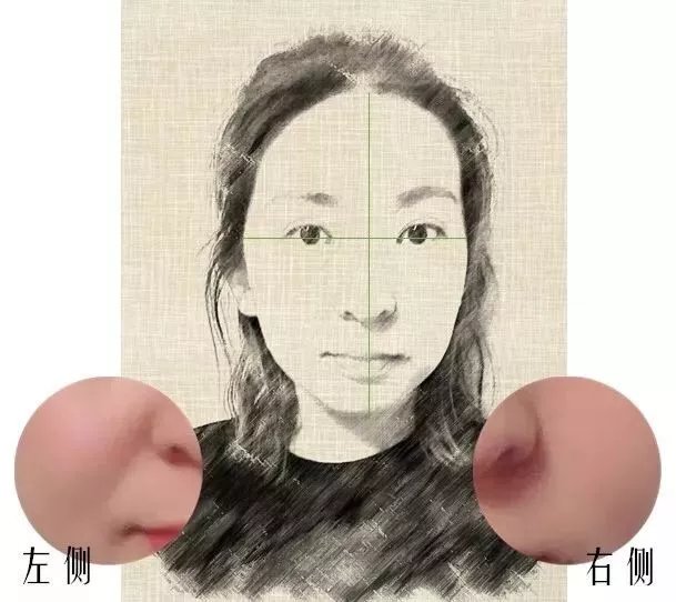 为什么有的人年纪轻轻就有法令纹？如何减弱法令纹？_百科TA说