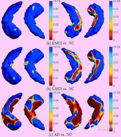 大脑功能网络动态图谱