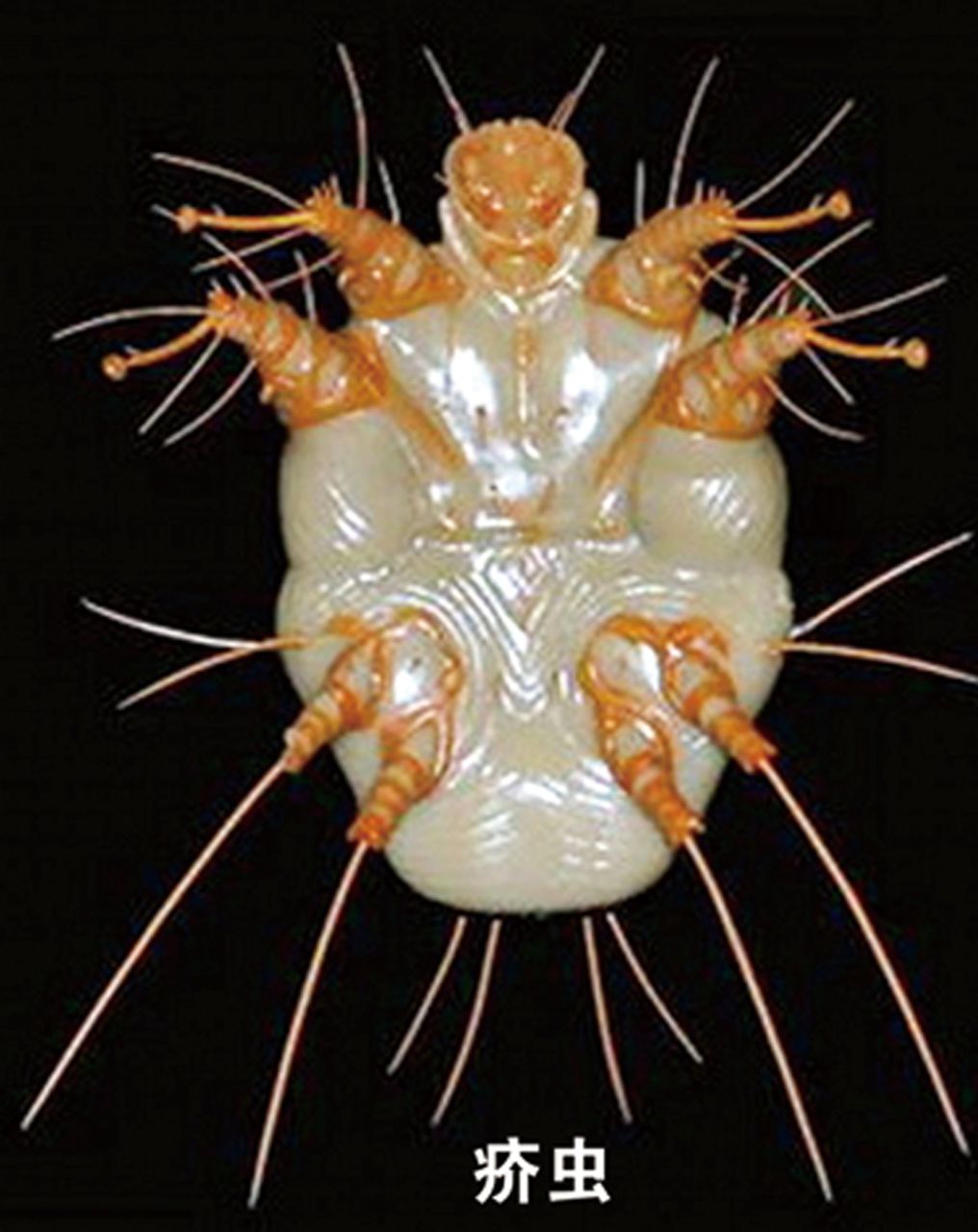 疥螨鸡皮疙瘩会自愈吗(得了疥疮没有疙瘩也痒痒)