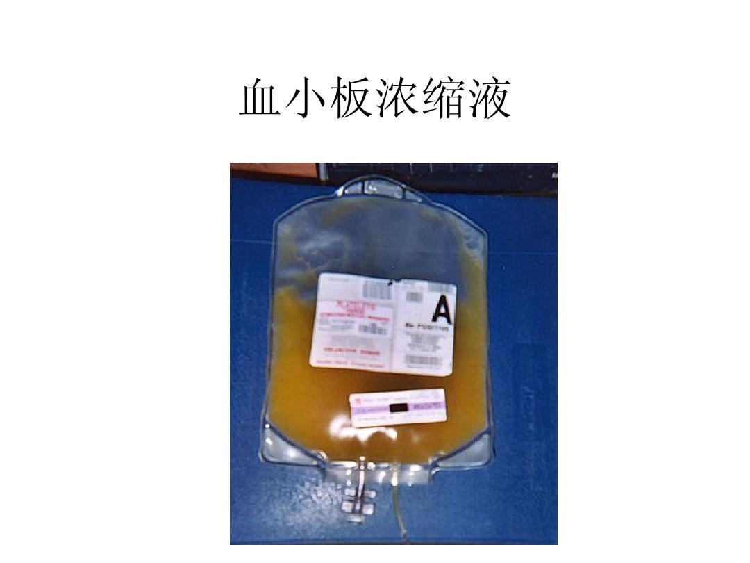 浓缩血小板