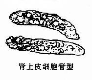 上皮管型即肾<a target="