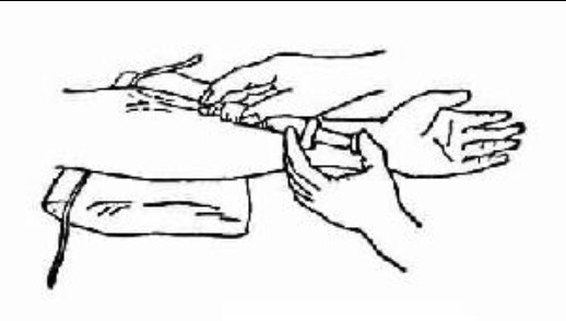  p data-id="go0czs9qt9">静脉推注,一种用注射器将少量或单一种类