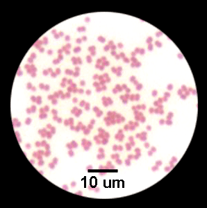 卡他莫拉菌肺炎