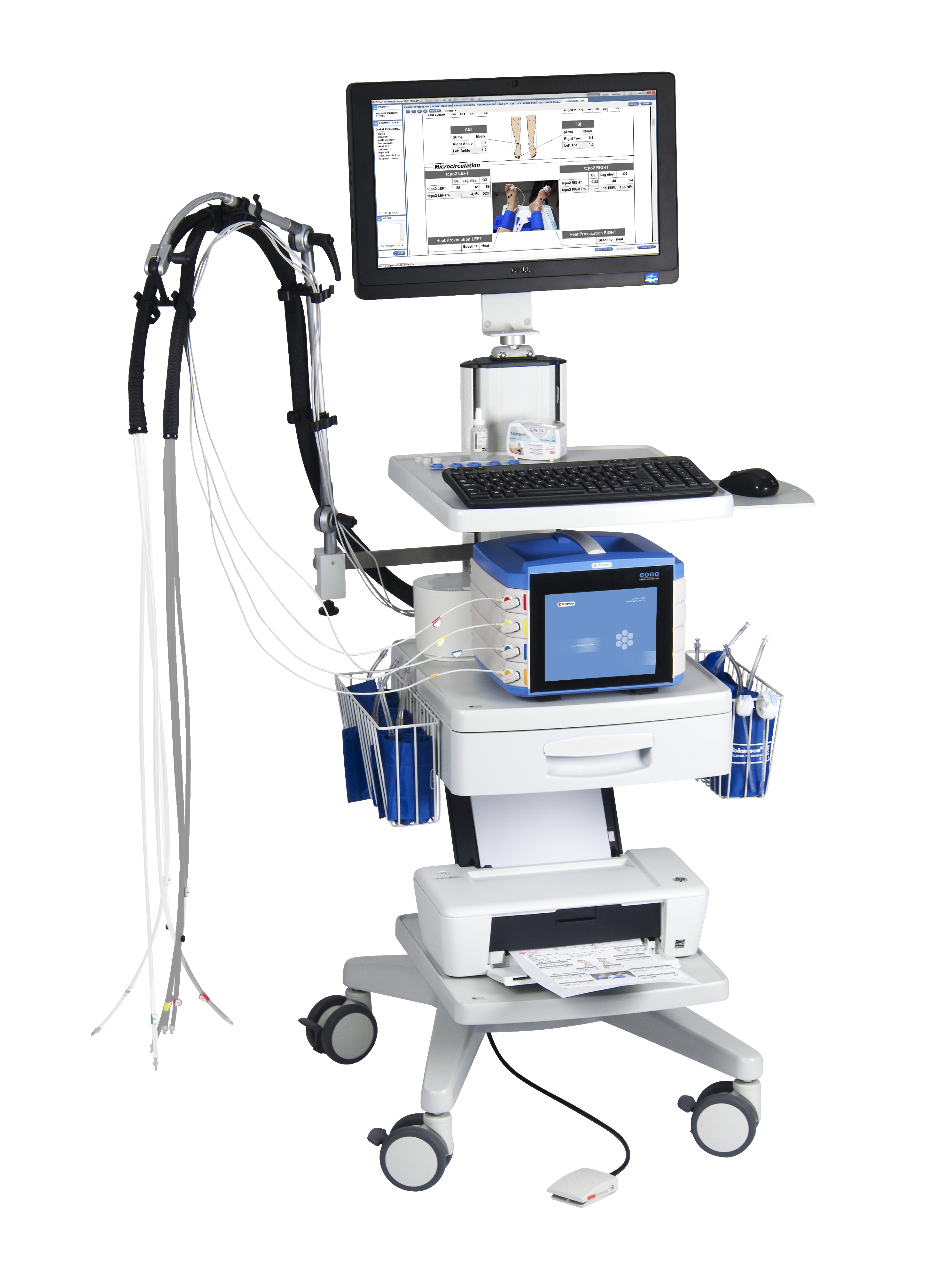 激光多普勒血流监测仪