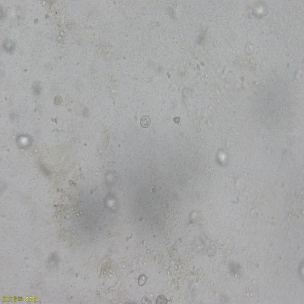 毒害艾美耳球虫