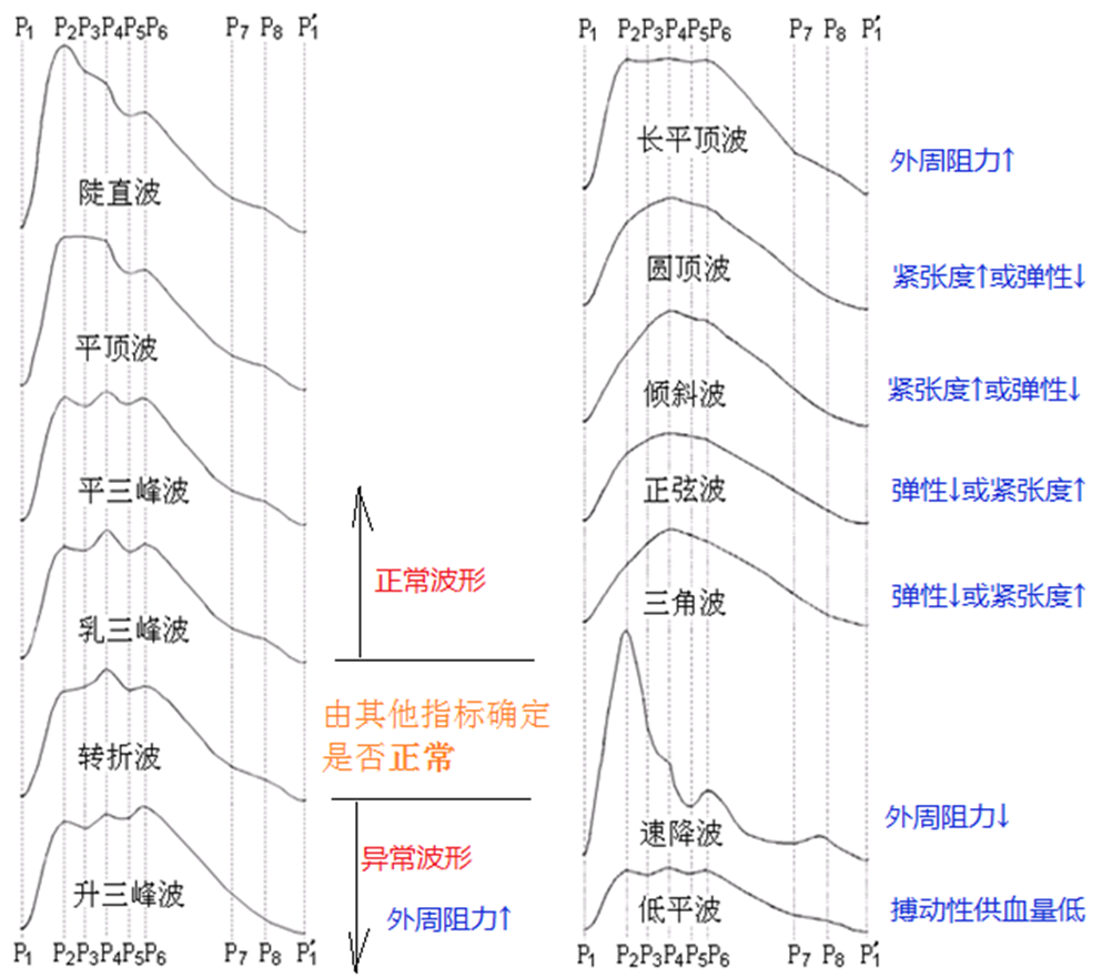 脑血流图