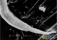 data-lemmaid="1519321">蛲虫 /a>,蛲虫属尖尾科,蛲虫属,成虫细小,乳