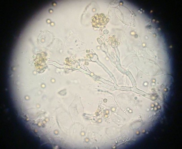 曲霉菌(aspergillus)