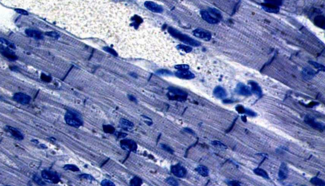  p>闰盘(intercalated disk)指的是相邻两心肌纤维的连接处. /p>