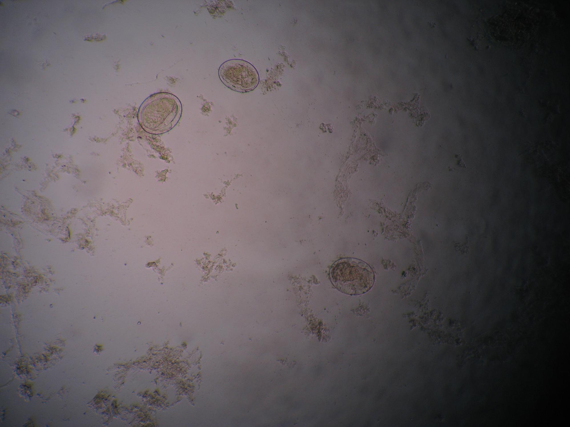 id="417982">血吸虫 /a>寄生于多数脊椎动物,寄生人体的有3种︰埃及 a