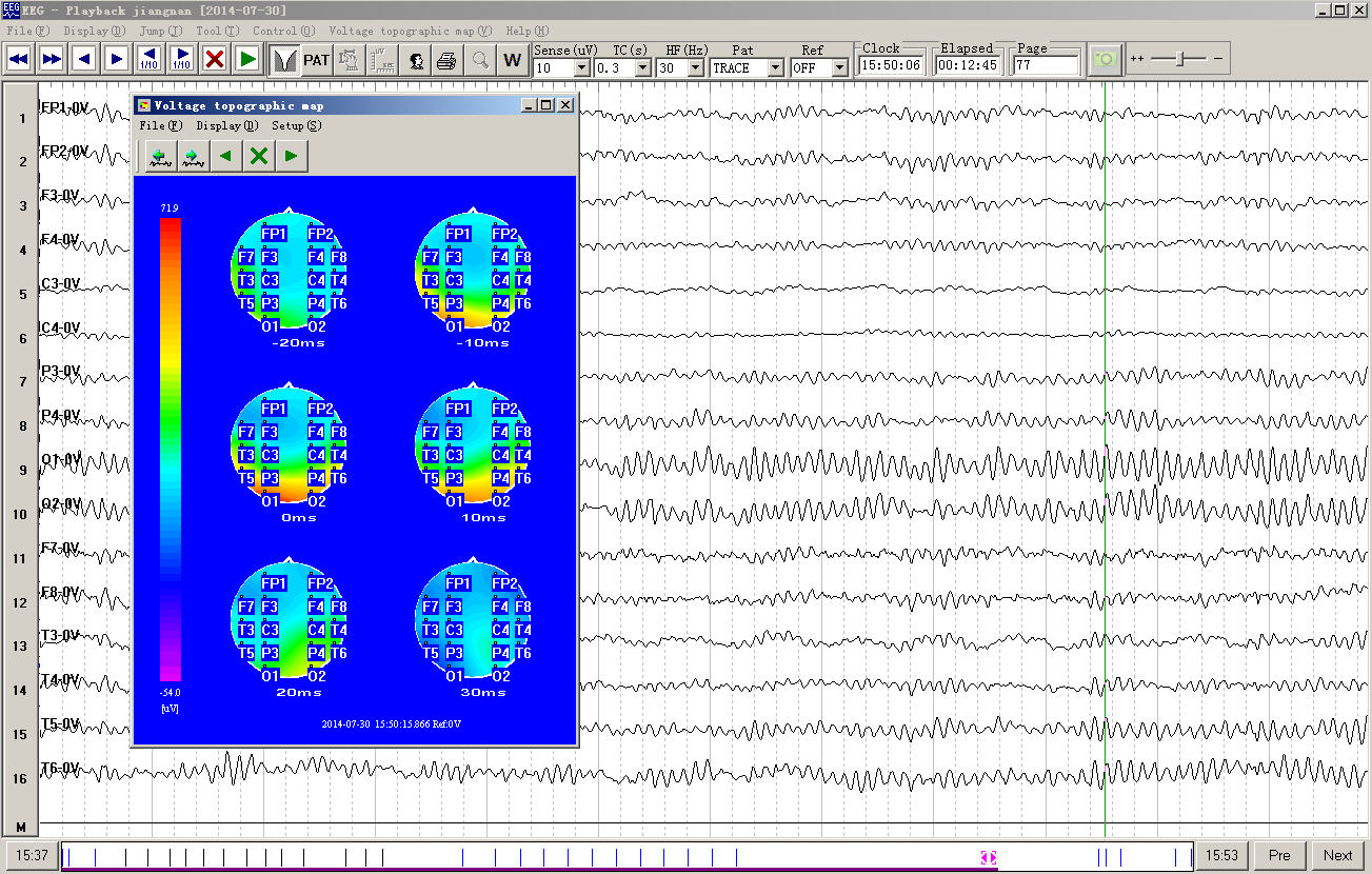 用于脑电信号的提取,放大,滤波,记录,分析,回放等.