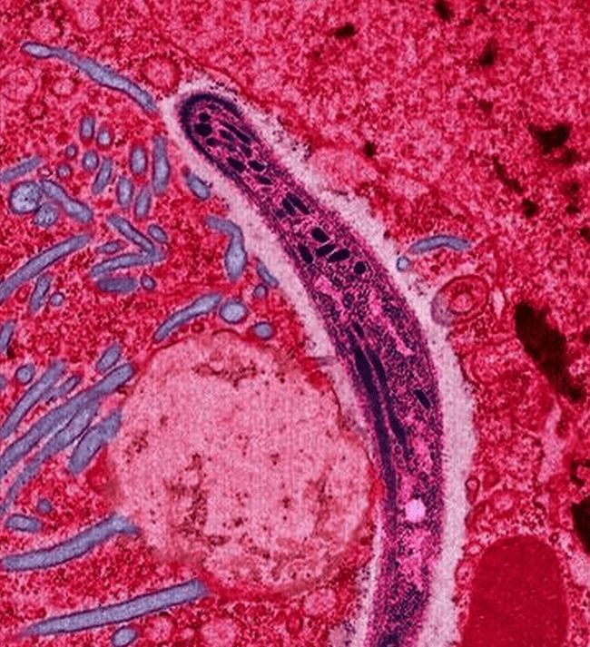  p>传染病(infectious diseases)是由各种病原体引起