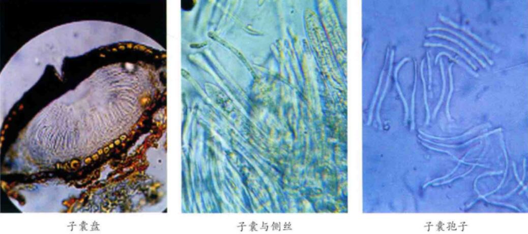 href="/item/油松/890953" data-lemmaid="890953">油松 /a>的病害