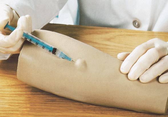  p>皮试是皮肤(或皮内)敏感试验的简称,是临床最常用的特异性检查.