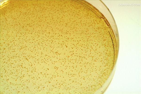  p>乳酸菌(lactic acid bacteria,lab)是一类能利用可发酵碳水化合物
