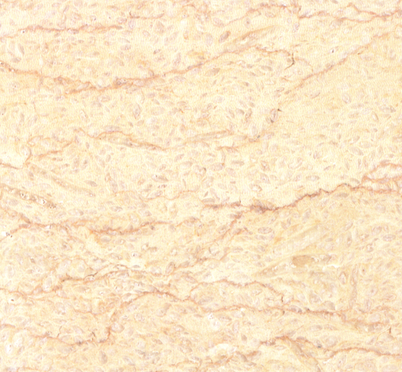  p>金线米黄-2是产于埃及的进口大理石. /p>