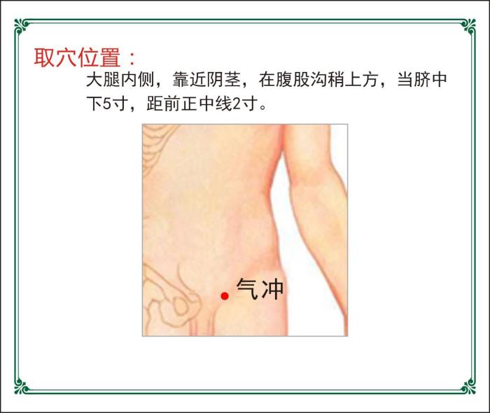 出自于《针灸甲乙经》,别名气街