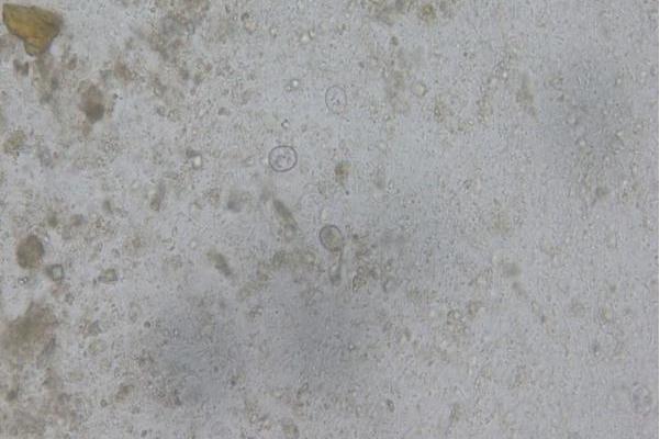 变位艾美耳球虫