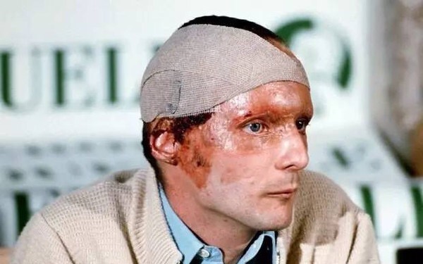  p>尼基·劳达( a target="_blank" href="/item/niki lauda/20254642
