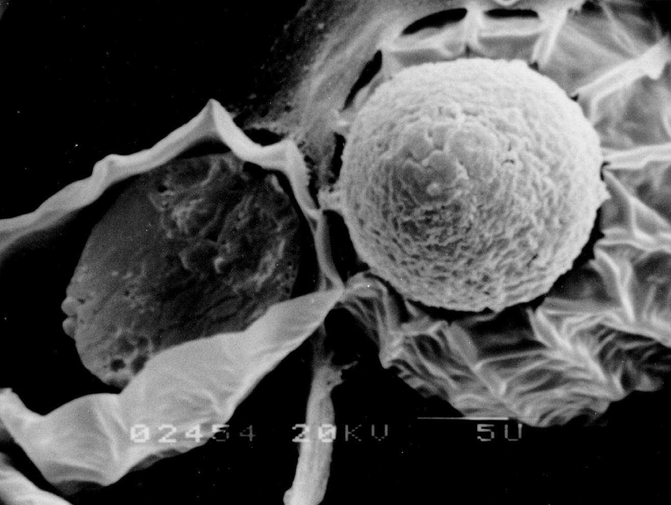  p>猪巨吻棘头虫是原棘头虫目寡棘吻科的一种棘头动物.