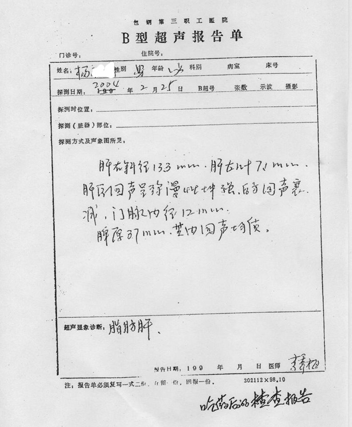 脾肿大通常与肝肿大有关,一般轻度脾肿大常是急性感染, a target="