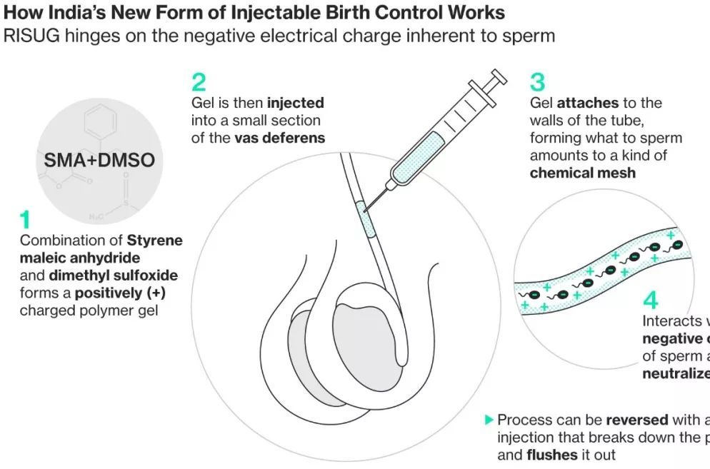 ="/item/vasalgel">vasalgel /a>的人工凝胶注射到男性的输精管里面