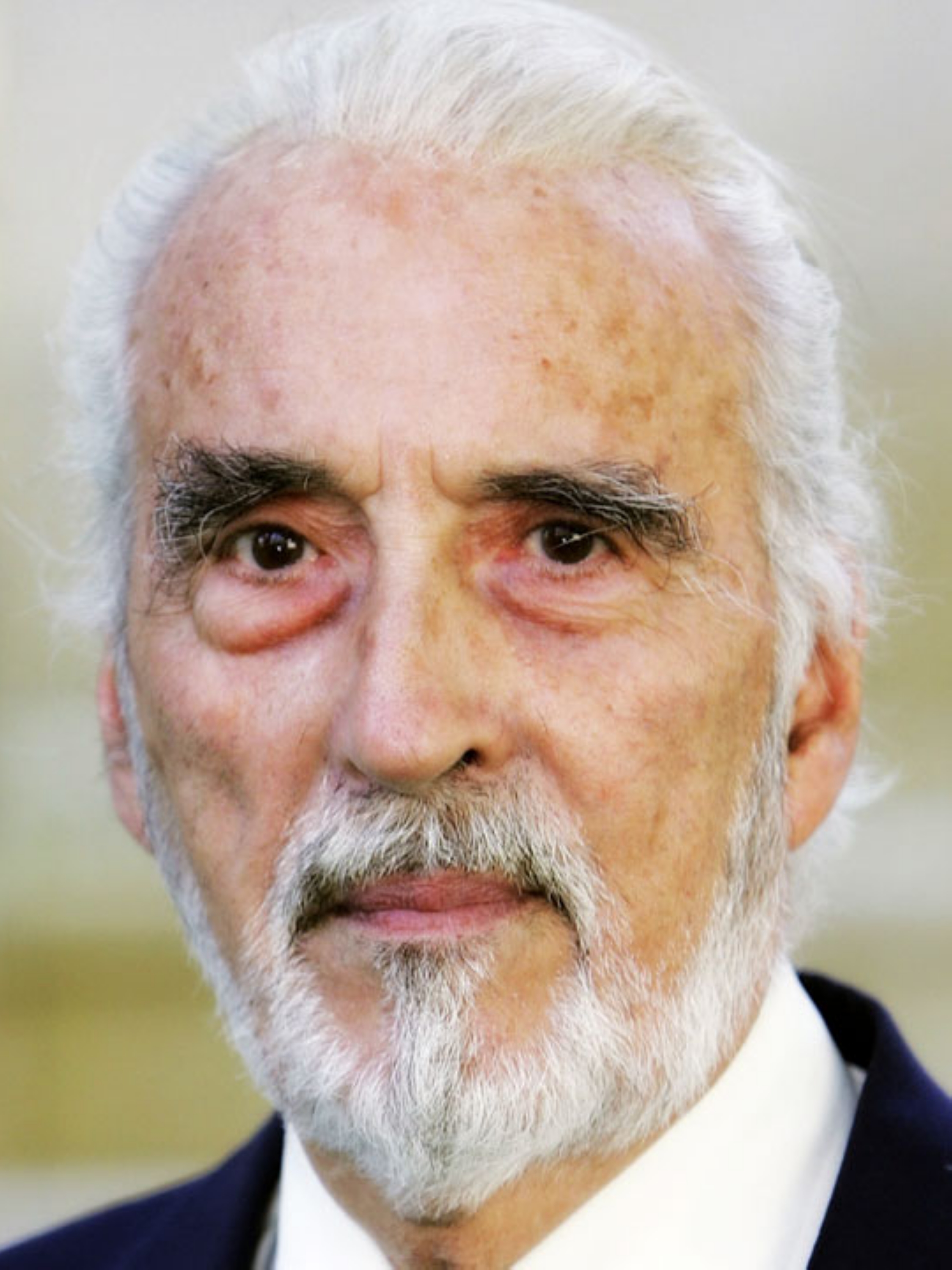 阿芒多·迪佩特