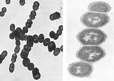 溶血性链球菌感染
