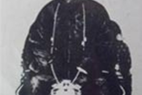 李莲英之死