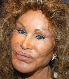 jocelyn wildenstein